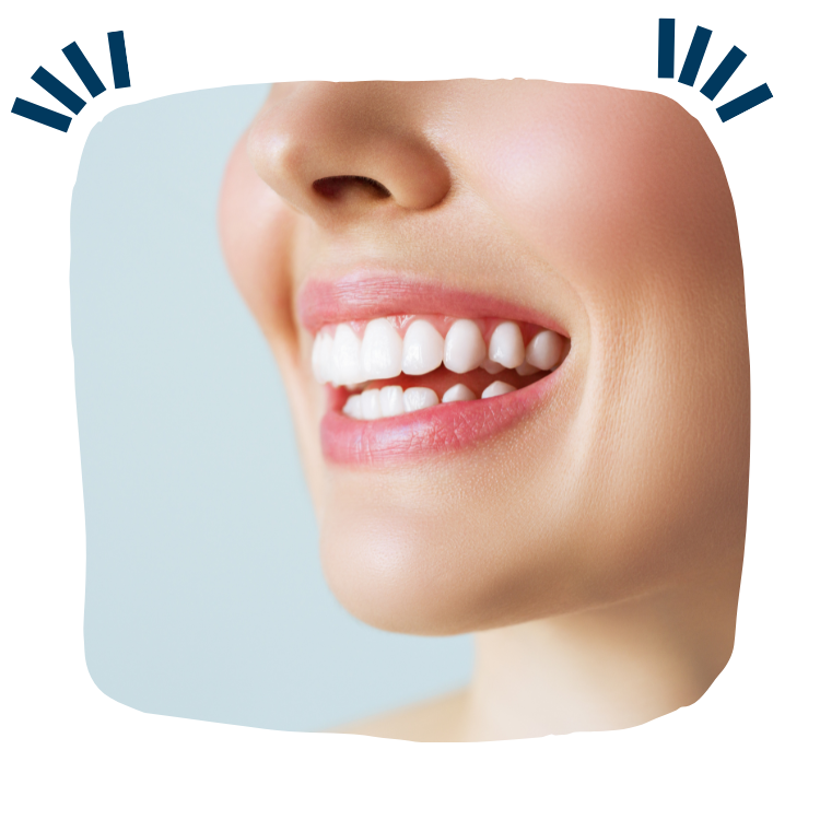 419 dental - teeth whitening
